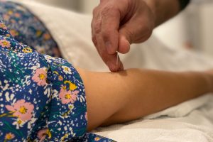 cgj alzheimers medication 2